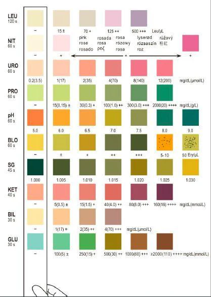 Areta 10 Parameter (10SG) Urinalysis Reagent Test Strips 50 Strips - Image 3