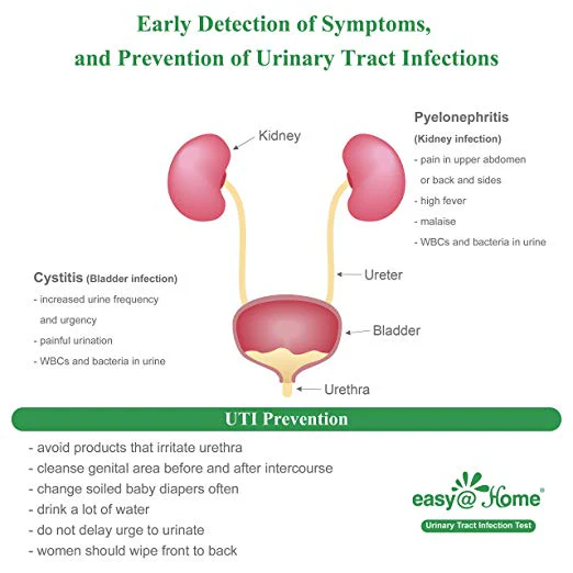 Easy@Home Urinary Tract Infection Test Strips, 10 Pack-FDA Approved - Image 5